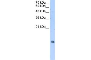 WB Suggested Anti-HIST2H2AA3 Antibody Titration:  2.