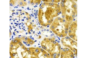 Immunohistochemistry of paraffin-embedded Human kidney using CDK20 Polyclonal Antibody at dilution of 1:100 (40x lens). (CCRK anticorps)
