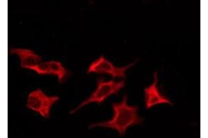 ABIN6276204 staining LOVO by IF/ICC. (GPR172B anticorps  (Internal Region))