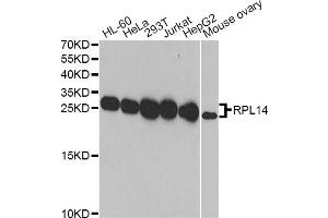 Western blot analysis of extracts of various cell lines, using RPL14 antibody (ABIN5974063) at 1/1000 dilution. (RPL14 anticorps)