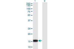 Western Blot analysis of C14orf129 expression in transfected 293T cell line by C14orf129 monoclonal antibody (M06), clone 2F2. (GSKIP anticorps  (AA 1-139))