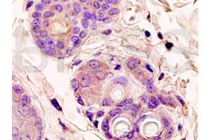 Formalin-fixed and paraffin embedded rat skin labeled with Anti-?