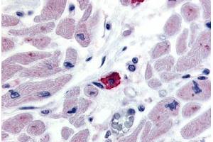 Anti-EMR3 antibody  ABIN1048549 IHC staining of human macrophage. (EMR3 anticorps  (N-Term))