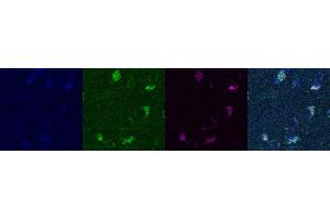 Immunohistochemistry (IHC) image for anti-Somatostatin (SST) antibody (ABIN7455969)