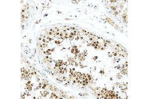 anti-Kinesin Family Member 2C (KIF2C) (AA 531-725) antibody