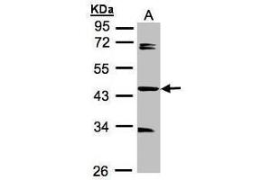 WB Image Sample A: 30μg of MOLT4 whole cell lysate , 10% SDS PAGE antibody diluted at 1:1000