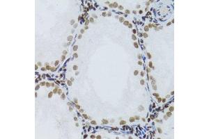 Immunohistochemistry of paraffin-embedded rat testis using NFKB2 Antibody.