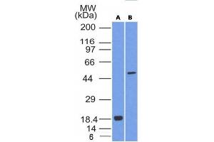Image no. 1 for anti-SRY (Sex Determining Region Y)-Box 10 (SOX10) (AA 115-269) antibody (ABIN6181137) (SOX10 anticorps  (AA 115-269))