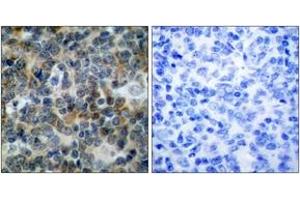 Immunohistochemistry analysis of paraffin-embedded human tonsil, using VASP (Phospho-Ser238) Antibody.