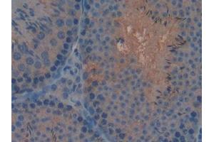 Detection of APC in Mouse Testis Tissue using Polyclonal Antibody to Adenomatosis Polyposis Coli Protein (APC)