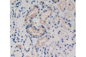 Used in DAB staining on fromalin fixed paraffin- embedded kidney tissue