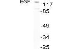 Western blot analysis of EGF in extracts from NIH-3T3 cells using anti-EGF antibody (EGF anticorps)