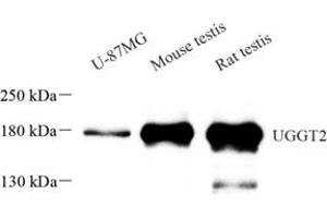Western blot analysis of UGGT2 (ABIN7076141) at dilution of 1: 1000 (UGCGL2 anticorps)