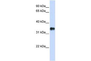 KCTD7 anticorps  (N-Term)