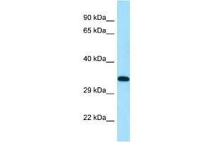 WB Suggested Anti-DSN1 Antibody Titration: 1. (DSN1 anticorps  (N-Term))