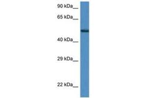Image no. 1 for anti-Zinc Finger Protein 275 (ZNF275) (AA 350-399) antibody (ABIN6747226) (ZNF275 anticorps  (AA 350-399))