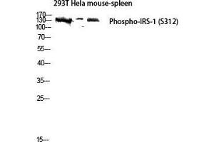Western Blot (WB) analysis of 293T HeLa Mouse Spleen lysis using Phospho-IRS-1 (S312) antibody.