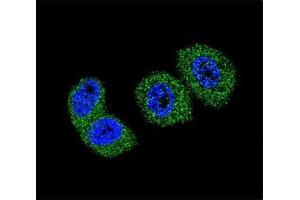 Confocal immunofluorescent analysis of FOXO3 antibody with MCF-7 cells followed by Alexa Fluor 488-conjugated goat anti-rabbit lgG (green).
