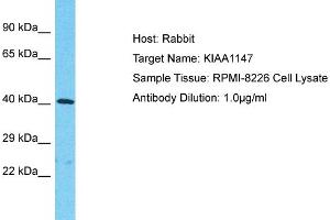 Host: Rabbit Target Name: KIAA1147 Sample Tissue: Human RPMI-8226 Whole Cell Antibody Dilution: 1ug/ml (DENND11/KIAA1147 anticorps  (C-Term))