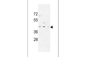 PR38A Antibody (C-term) (ABIN653884 and ABIN2843131) western blot analysis in MDA-M,CEM,HL-60 cell line lysates (35 μg/lane). (PRPF38A anticorps  (C-Term))