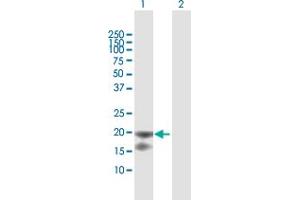 Western Blot analysis of IL1RN expression in transfected 293T cell line by IL1RN MaxPab polyclonal antibody.