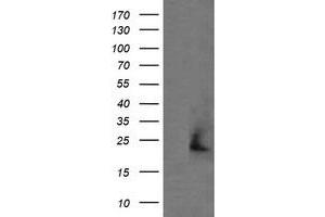 Image no. 1 for anti-Amyloid P Component, Serum (APCS) antibody (ABIN1500900) (APCS anticorps)
