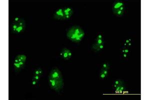 Immunofluorescence of purified MaxPab antibody to C14orf169 on HeLa cell. (C14orf169 + NO66 anticorps  (AA 1-641))