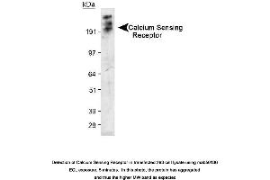Image no. 1 for anti-Calcium-Sensing Receptor (CASR) (Extracellular Domain), (N-Term) antibody (ABIN363290)