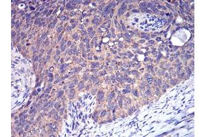 Immunohistochemistry (IHC) image for anti-Complement Factor H-Related 5 (CFHR5) (AA 344-569) antibody (ABIN5923027) (CFHR5 anticorps  (AA 344-569))