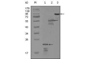 Western blot analysis using ERBB3 mouse mAb against truncated Trx-ERBB3 recombinant protein (1), MBP-ERBB3 (aa1175-1275) recombinant protein (2) and truncated ERBB3(aa665-1342)-hIgGFc transfected CH0-K1 cell lysate (3). (ERBB3 anticorps)