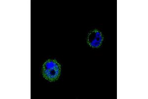 Confocal immunofluorescent analysis of VPS52 Antibody (C-term) (ABIN654879 and ABIN2844533) with MCF-7 cell followed by Alexa Fluor® 488-conjugated goat anti-rabbit lgG (green). (VPS52 anticorps  (C-Term))