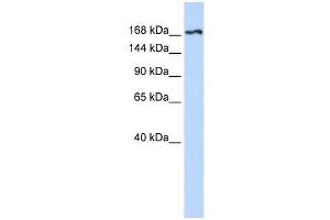Western Blot showing KDR antibody used at a concentration of 1-2 ug/ml to detect its target protein. (VEGFR2/CD309 anticorps  (N-Term))