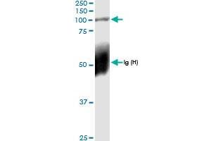 Immunoprecipitation of PLOD2 transfected lysate using anti-PLOD2 MaxPab rabbit polyclonal antibody and Protein A Magnetic Bead , and immunoblotted with PLOD2 MaxPab rabbit polyclonal antibody (D01) . (PLOD2 anticorps  (AA 1-758))
