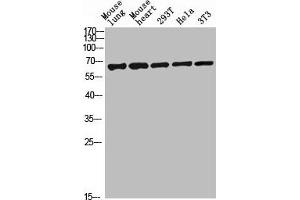 Western blot analysis of mouse-lung mouse-lung lysate, antibody was diluted at 2000.