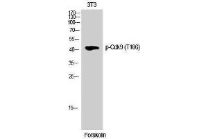 Western Blotting (WB) image for anti-Cyclin-Dependent Kinase 9 (CDK9) (pThr186) antibody (ABIN3182262)