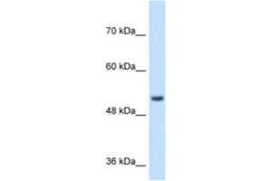 Western Blotting (WB) image for anti-Signal Peptide Peptidase-Like 2B (SPPL2B) antibody (ABIN2464000)