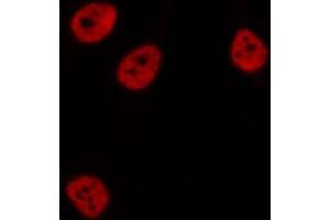 ABIN6276831 staining  Hela cells by IF/ICC. (CTBP1 anticorps  (Internal Region))