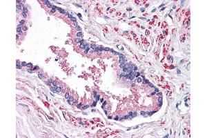 Anti-STEAP2 antibody IHC of human prostate.