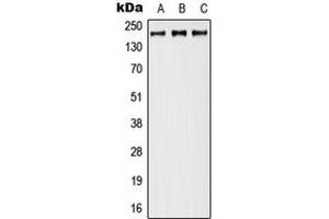 Western blot analysis of Neurocan expression in MCF7 (A), Raw264. (Neurocan anticorps  (Center))