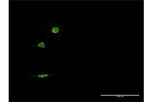 Immunofluorescence of monoclonal antibody to NR1D1 on HeLa cell.