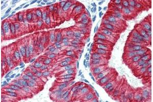 Uterus, Human: Formalin-Fixed, Paraffin-Embedded (FFPE) (Cytokeratin 19 anticorps  (C-Term))