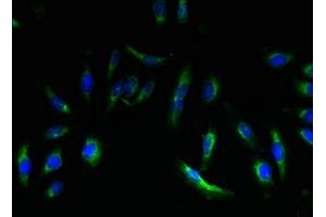 Immunofluorescent analysis of Hela cells using ABIN7151933 at dilution of 1:100 and Alexa Fluor 488-congugated AffiniPure Goat Anti-Rabbit IgG(H+L)