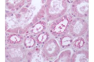 Human Kidney: Formalin-Fixed, Paraffin-Embedded (FFPE)