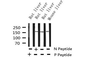 Western blot analysis of Phospho-EGFR (Tyr1016) expression in various lysates (EGFR anticorps  (pTyr1016))