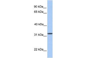 WB Suggested Anti-SIGLEC12 Antibody Titration:  0. (SIGLEC12 anticorps  (N-Term))
