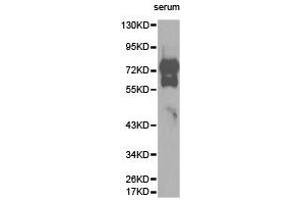 Western Blotting (WB) image for anti-Vitronectin (VTN) antibody (ABIN1875340) (Vitronectin anticorps)