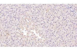 Detection of C1INH in Human Liver Tissue using Monoclonal Antibody to Complement 1 Inhibitor (C1INH) (SERPING1 anticorps  (AA 399-500))