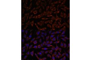Immunofluorescence analysis of L929 cells using BZW2 antibody (ABIN7265831) at dilution of 1:100.