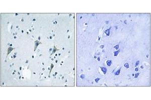 Immunohistochemistry analysis of paraffin-embedded human brain tissue, using GPR85 Antibody. (GPR85 anticorps  (AA 181-230))