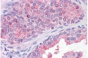 Anti-TM9SF1 antibody  ABIN1049413 IHC staining of human, prostate.